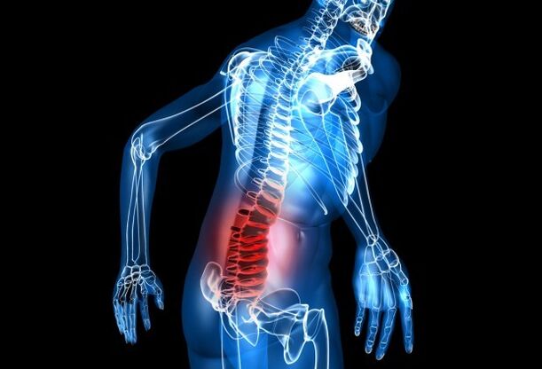 Objawy osteochondrozy