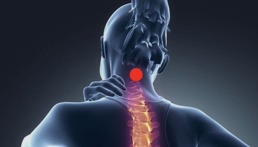 objawy osteochondrozy szyjnej