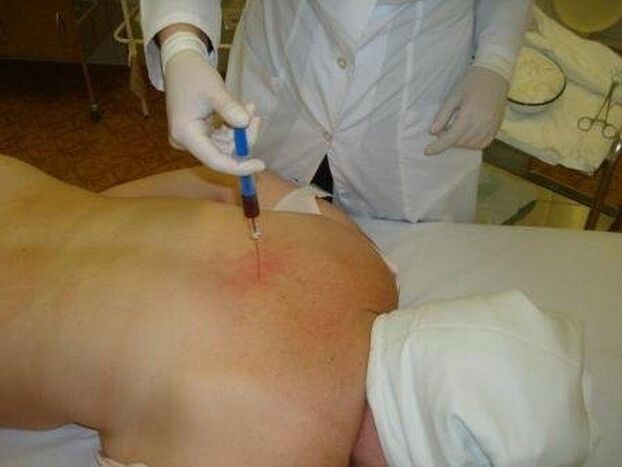 Przygotowania do osteochondrozy